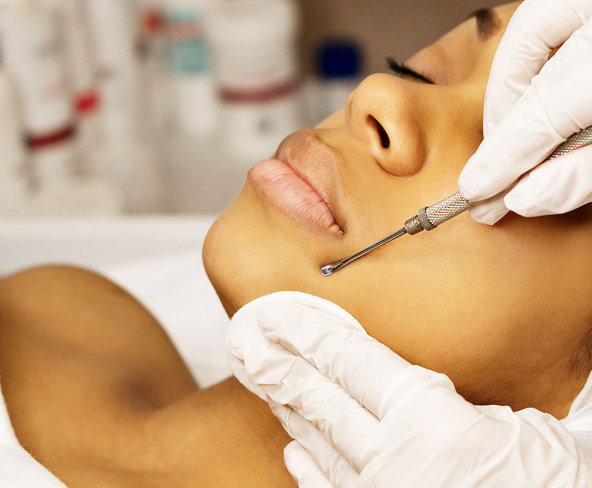 Acne Treatment - LifeTime Dermatology